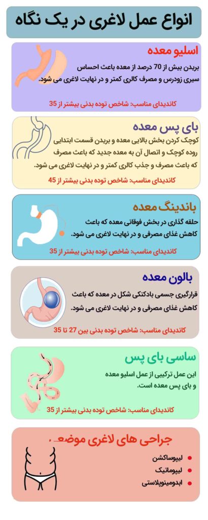 اینفوگرافی انواع عمل لاغری