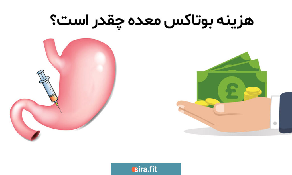 هزینه بوتاکس معده